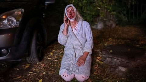 Una mujer en pijama y herida al tener que salir de su casa en Kiev tras el bombardeo de un bloque de apartamentos
