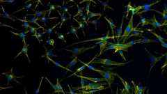 Un nuevo avance en la lucha contra el melanoma