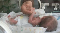 Fotograf�a de archivo de un beb� prematuro en la uci pedi�trica de un hospital gallego