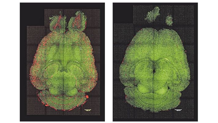 Cerebro de ratn. Alzhimer
