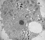 Imagen del �Pandoravirus�