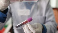Imagen de un laboratorio donde se extrae ADN