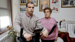 Lola, de 76 a�os, mira a su hijo Jorge, afectado por la enfermedad rara de Niemann Pick desde los 17. 