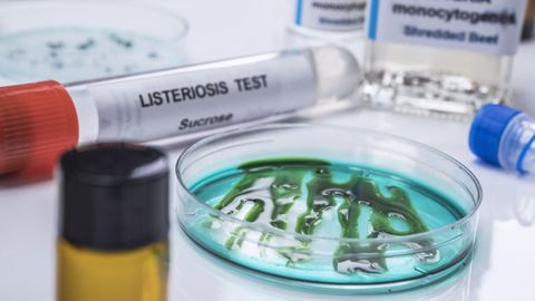 Imagen de archivo de una muestra bacteriol�gica para analizar carne contaminada con listeria.