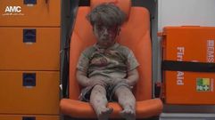 Omran, el ni�o que sobrevivi� al bombardeo en Aleppo
