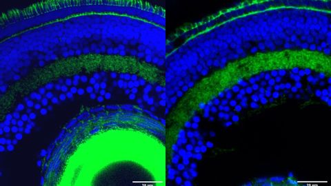 A la derecha, la retina de un pez cebra con el gen desactivado. La imagen de la izquierda muestra la visin normal.