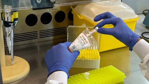 El test sangu�neo MAP-AD� de la compa��a ADmit Therapeutics, que predice el alzh�imer.