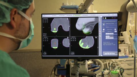 M�s de 12.400 personas esperan por una cirug�a en el �rea sanitaria de Santiago