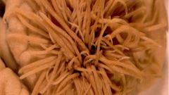 Est�mago de delf�n que muestra una �lcera g�strica con presencia de par�sitos