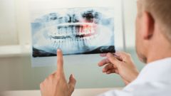 Imagen de la consulta de un dentista, que supone uno de los desembolsos m&aacute;s importantes del gasto sanitario de las familias.