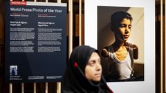 Este retrato de Mahmud Ajjour, un nio gazat de nueve aos que fue mutilado por un misil israel, es obra de la fotgrafa palestina Samar Abu Elouf para The New York Times y la mejor foto del ao.