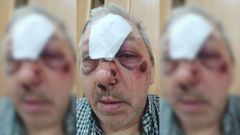 Manuel Temes Rodr�guez, v�ctima de una agresi�n en Pontevedra