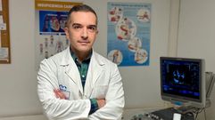 Mario Gutirrez, jefe de Cardiologa del CHUO.