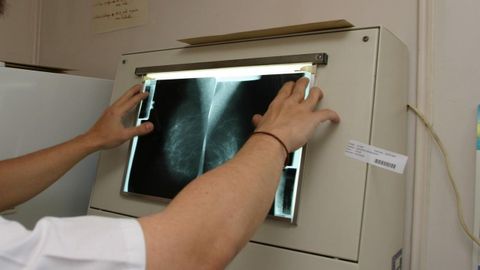 Mamografa realizada en Ourense