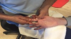 Bruno Hortelano muestra su mano derecha operada en tres ocasiones