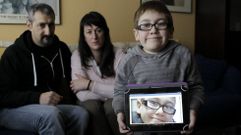 Miguel sufre s�ndrome de Morquio