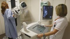 Una prueba de mamograf�a