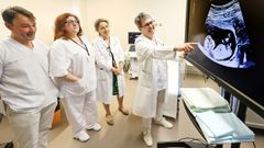 Equipo de Obstetricia del Hospital �lvaro Cunqueiro que dirige Emilio Couceiro, a la derecha. 