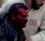 Imagen de un herido en el ataque en Al Maliha colgada en Youtube.