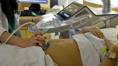 endometriosis