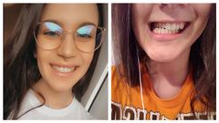 KALI BUSTO MEIR�S DESPU�S Y ANTES DE LA OPERACI�N