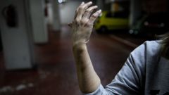 Mar�a muestra las marcas de los dedos que le dej� su atacante en los brazos y las mu�ecas.