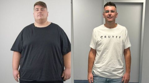 Comparativa entre el antes y el despus de Gerard.