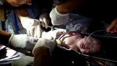 Minucioso rescate del beb� que sufri� algunos ara�azos y cortes