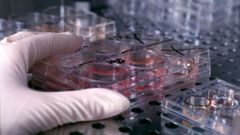 En todo el mundo se est�n realizando investigaciones para encontrar una vacuna o un tratamiento para el SARS-CoV-2